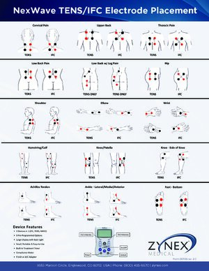 IFC Electrode Placement