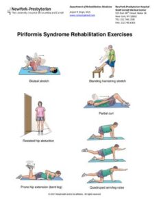 Piriformis Syndrome thumbnail