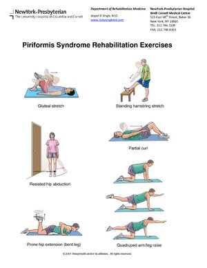 Thumbnail for Piriformis Syndrome