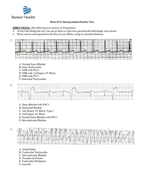 Practice EKG Strips With Answers