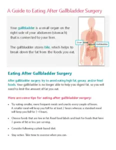 A Guide to Eating After Gallbladder Surgery