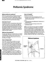 Thumbnail for Piriformis Syndrome