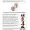 Thumbnail for TMJ Exercises